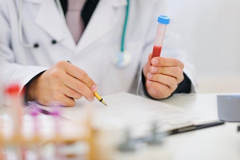 Doctor reviewing blood test results